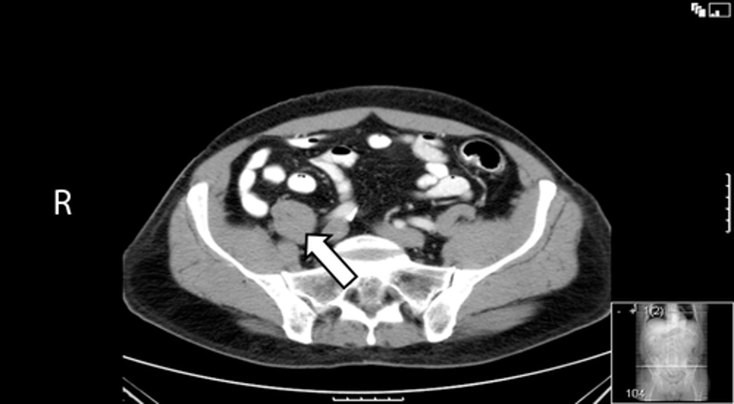 <p>What is indicated in the image?</p>