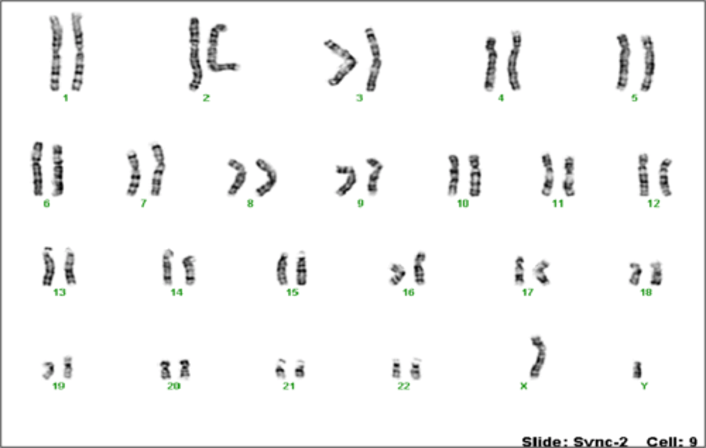<p>Has a y chromosome and an x chromosome</p>