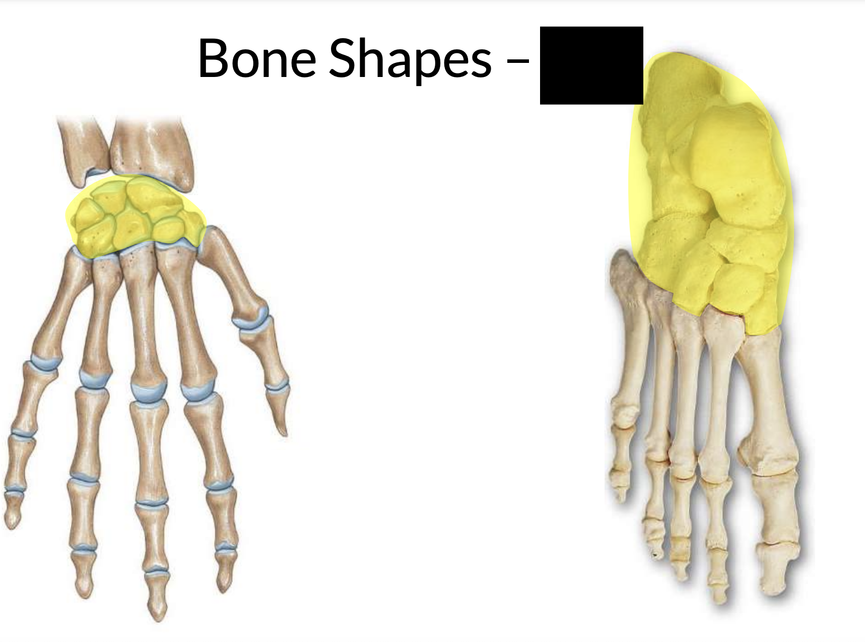 What bone shape is this?