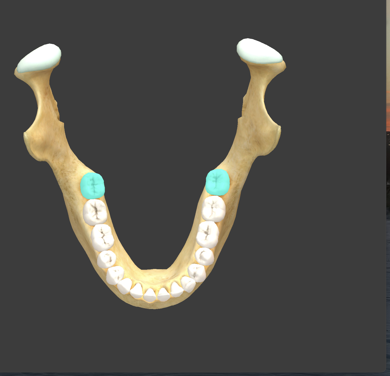 <p>-Note: not everyone has these, they are wisdom teeth and can be surgically removed</p>