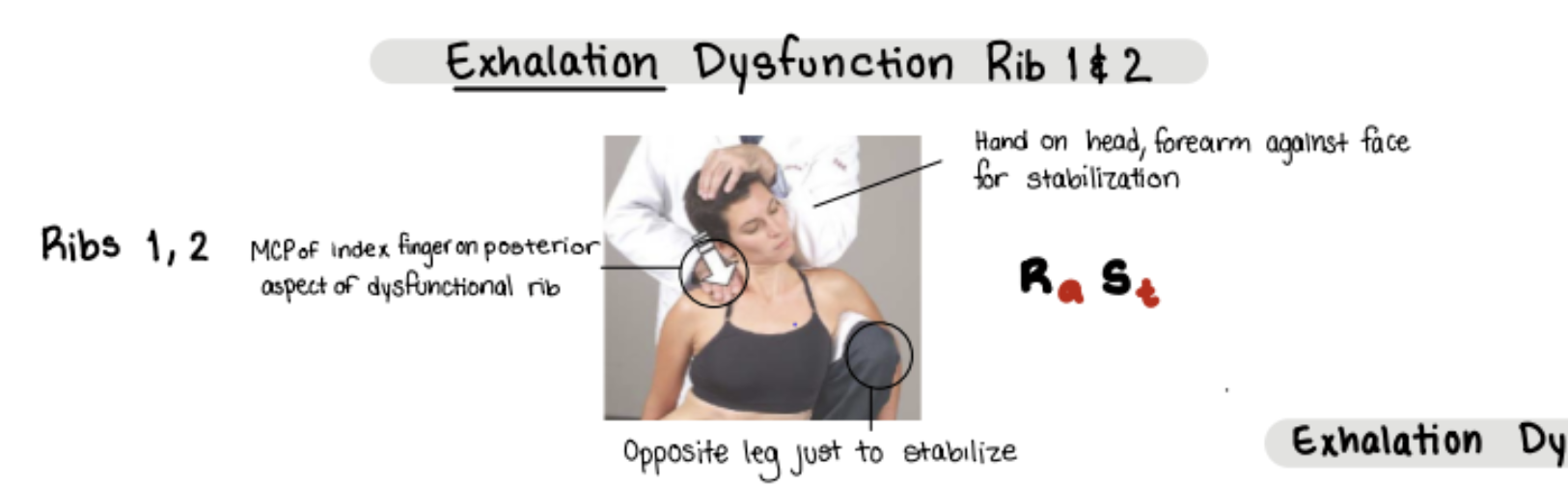<p>Get the patient to sit down.</p><ul><li><p>Get index finger’s MCP on posterior aspect of rib</p></li><li><p>Use your other hand to STAR</p></li><li><p>Use opposite leg to stabilize</p></li></ul><p></p>