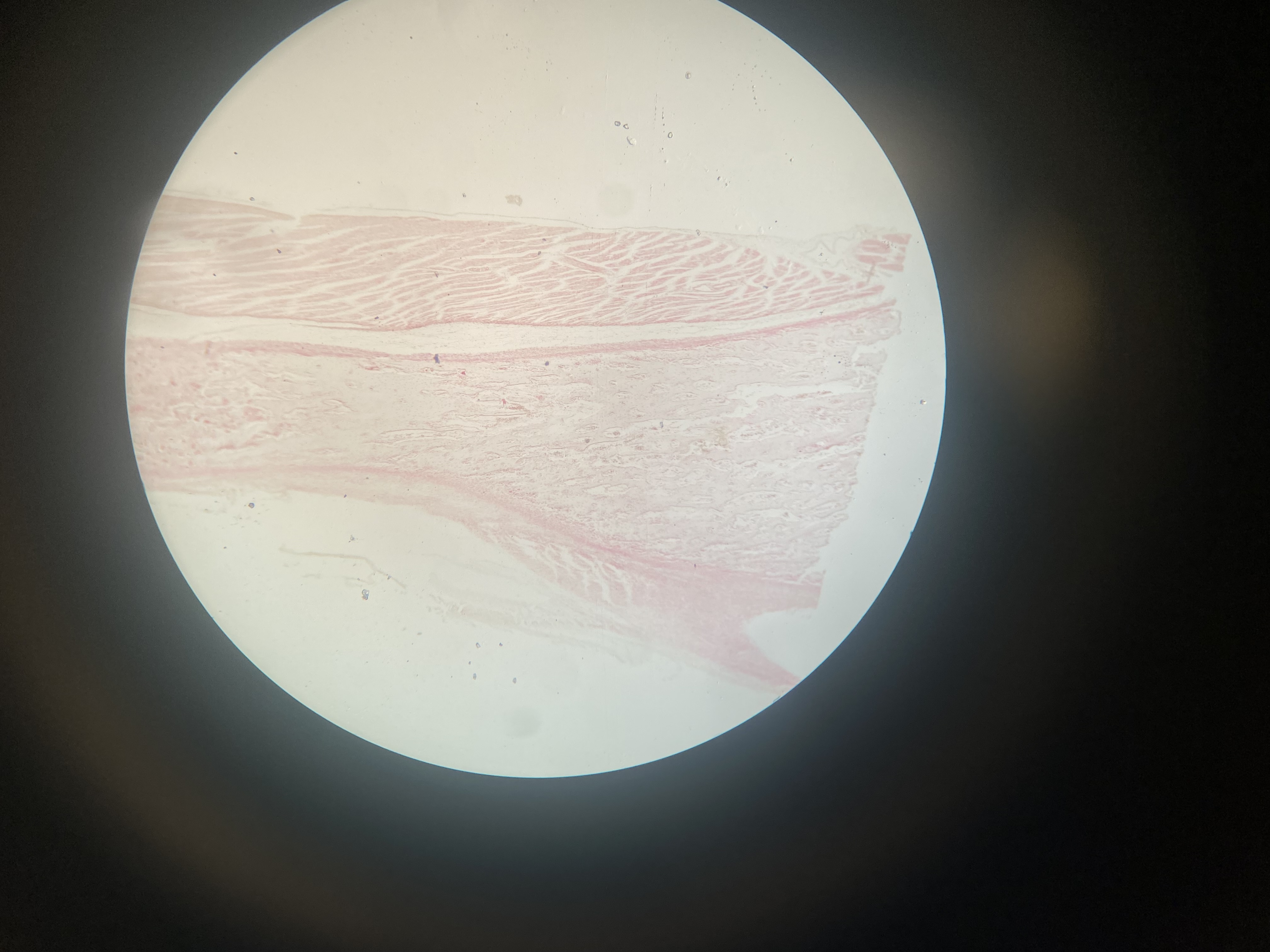 <p>Identify</p>