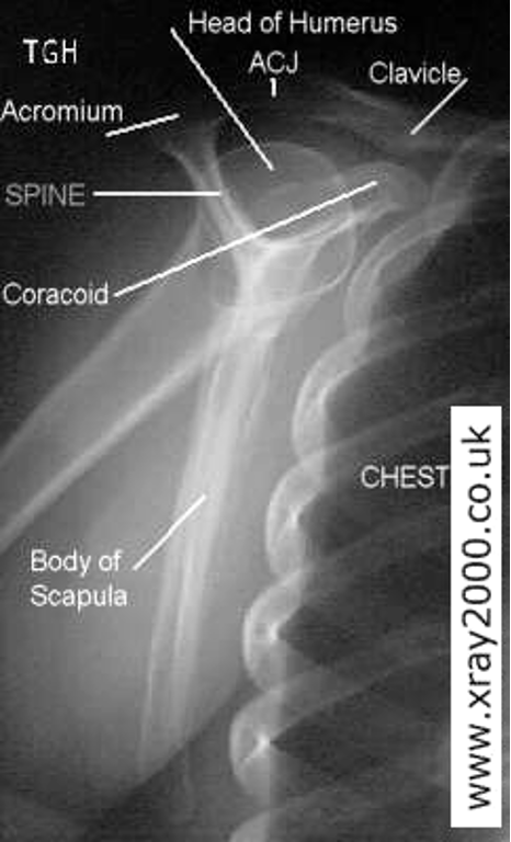 <p>coracoid, spine of scapula, body of scapula</p><p>humeral head should be in center of the “Y”</p>