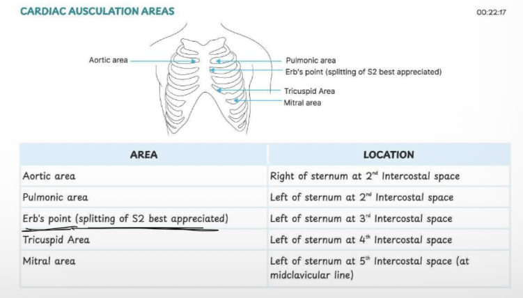 <p>Five standard areas</p>