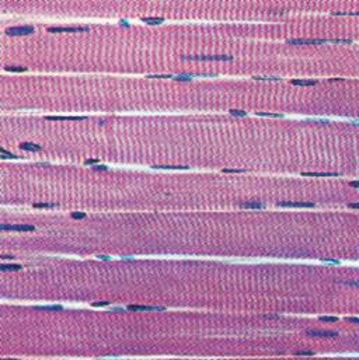 <p>A muscle that is attached to the bones of the skeleton and provides the force that moves the bones.</p>