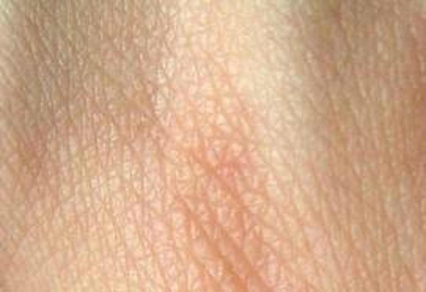 <p>the skin</p>