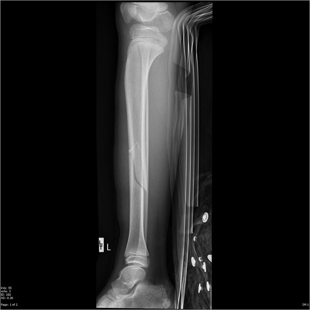 <p>What is the plane of this fracture?</p>