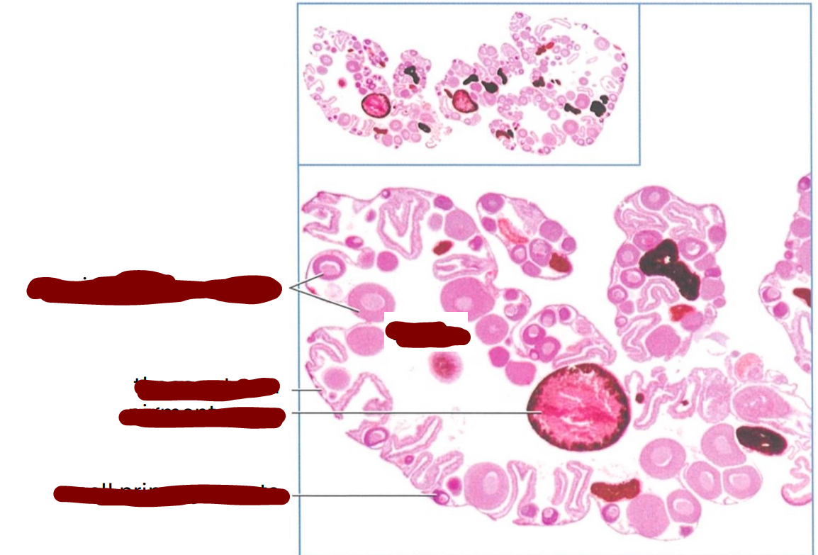 <p>section through the sacculate ovary of an adult frog </p>