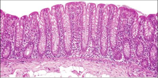 <p>-Haustra: pocket-like sac lining, allowing for expansion</p><p>-Intestinal crypts</p><p>-Goblet cells (white dots)</p><p>-Enterocytes: absorb water</p><p>(simple columnar)</p>