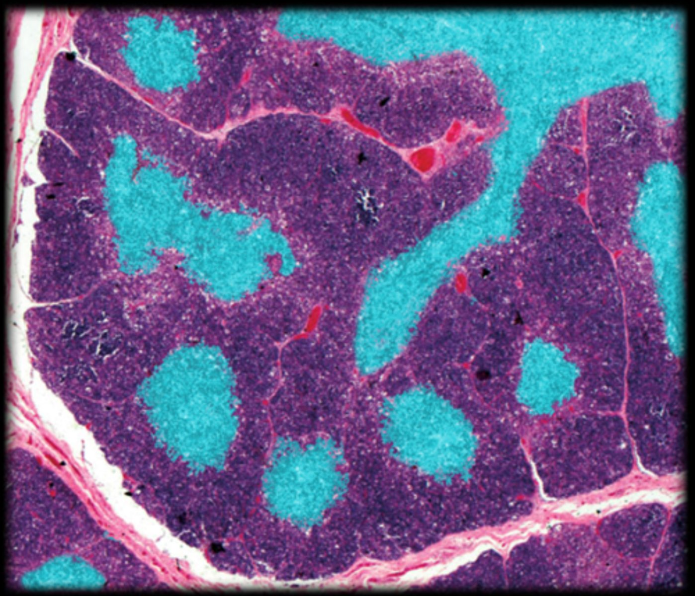 <p>Fetal thymus</p>