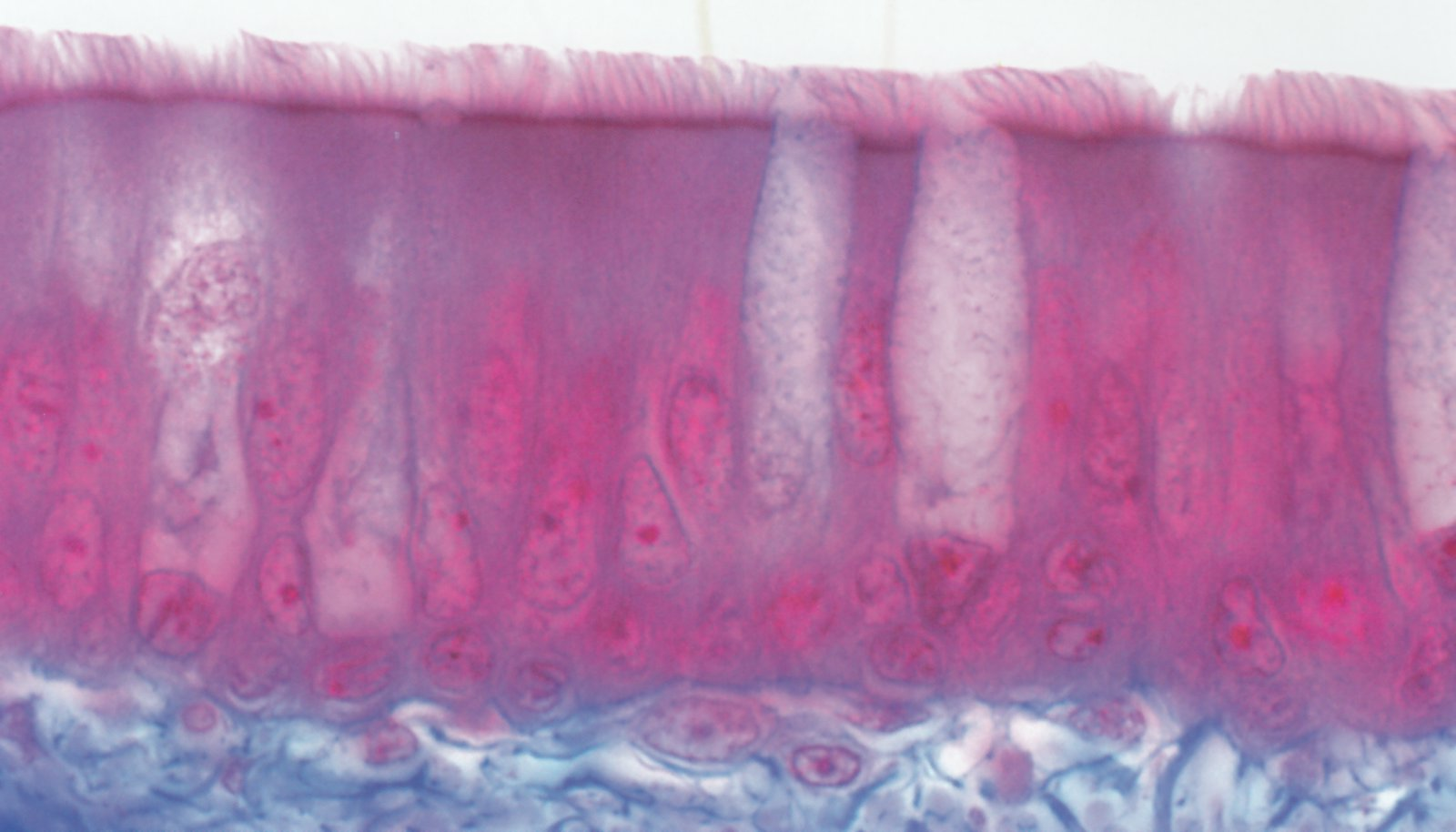 <p>A. Bronchial system</p>
