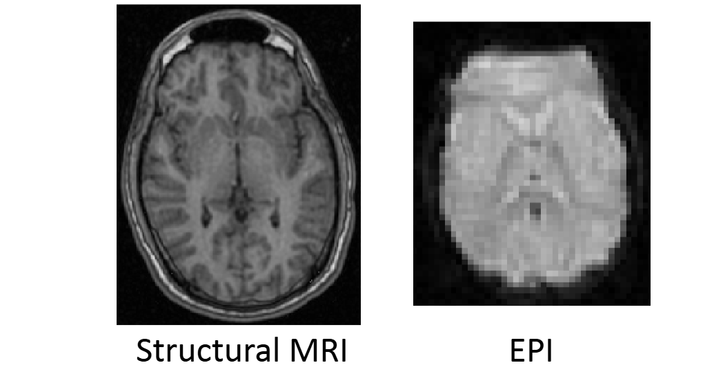 <p>Functional structural coregistration</p>