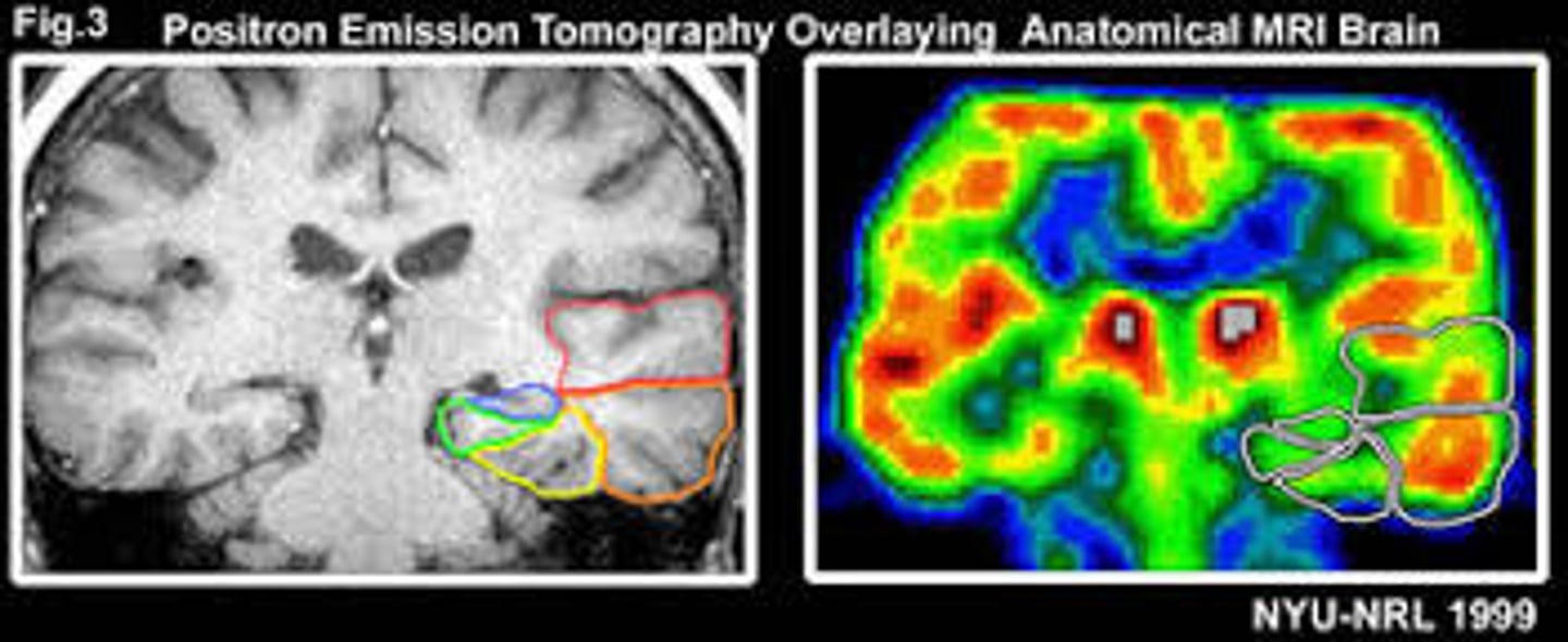 <p>(A) PET scans</p>