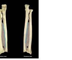 sharp lateral edge of shaft