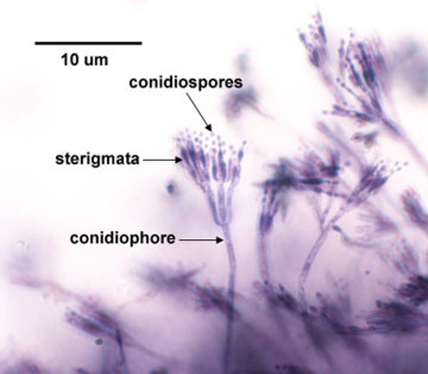 <p>fungi</p><p>phialides</p><p>conida</p><p>conidiophore</p>