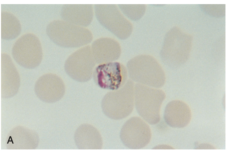 <p>A species of Plasmodium that causes malaria.</p>