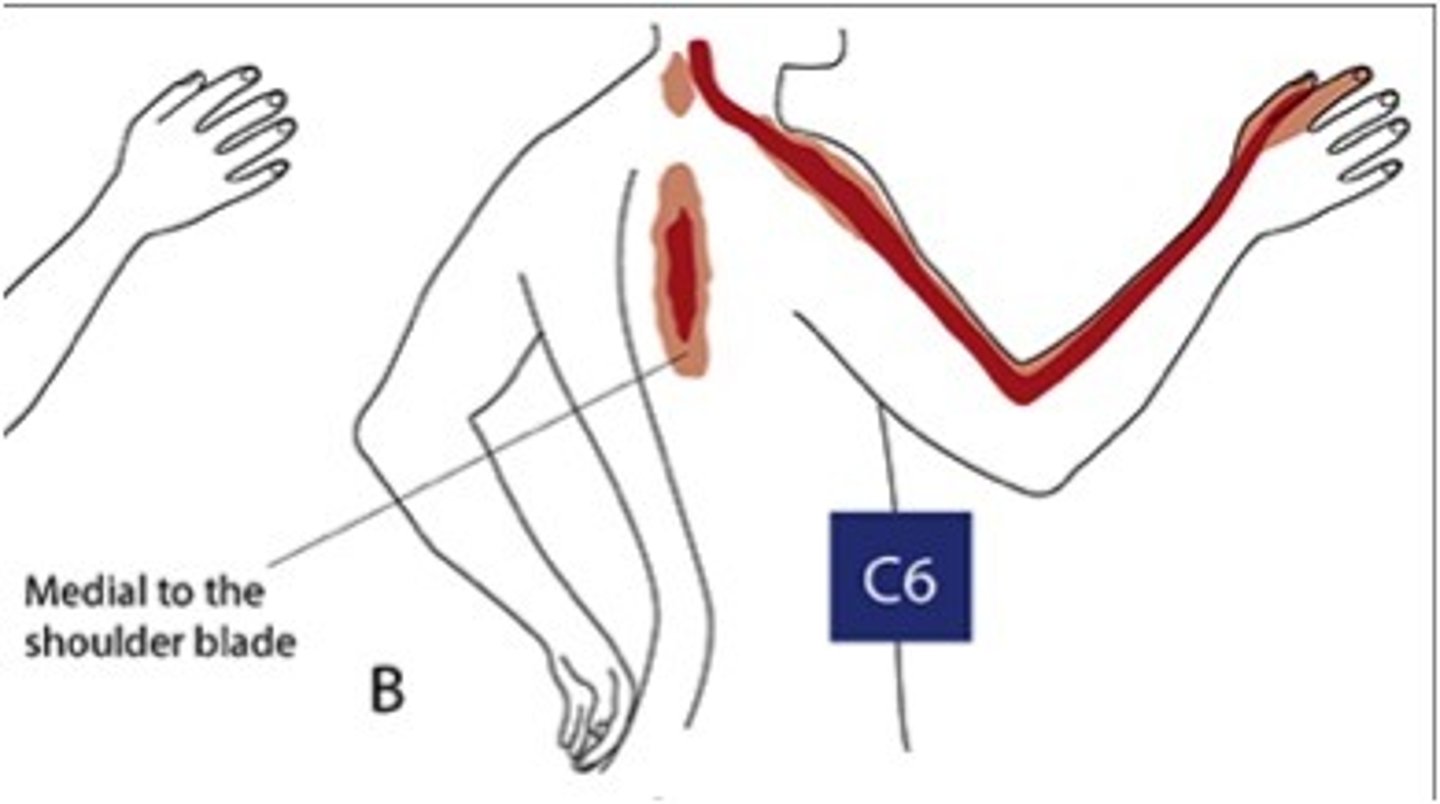 <p>Neck pain, paresthesia to thumb &amp; index fingers, ↓ brachioradialis reflex, weakness in C6-innervated muscles (brachioradialis, wrist extensors)</p>
