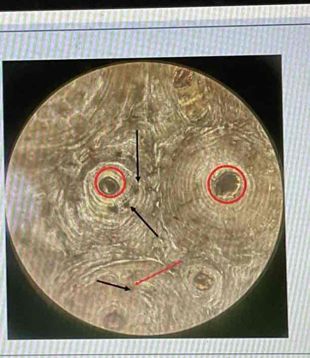 <p>What part of the specimen is shown in the picture (naglibog ko unsaon ni pag construct tabanggg)</p>