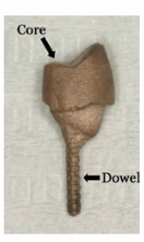 <p>used when part or the entire supragingival part of the tooth is missing or when the remaining hard dental tissues cannot provide sufficient support for the crown </p>