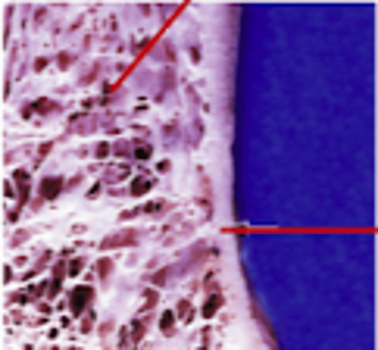 <p>Identify the types of bone in this image</p>