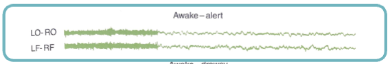 <p>alert wakefulness</p>