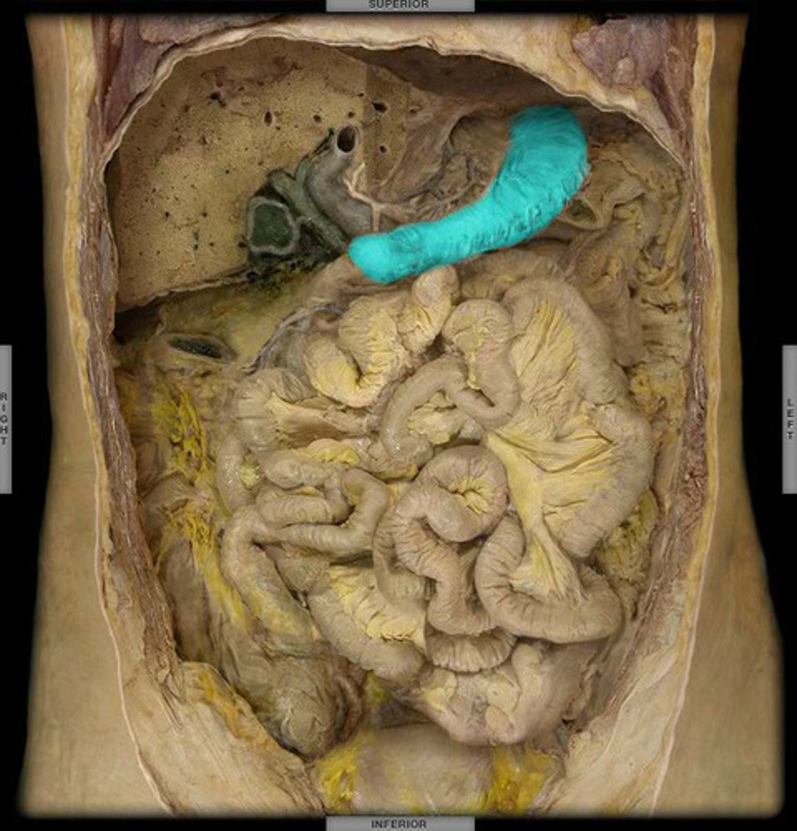 <p>A J-shaped, muscular pouch located in the abdomen.</p>