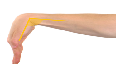 <p>what movement is this and why</p>