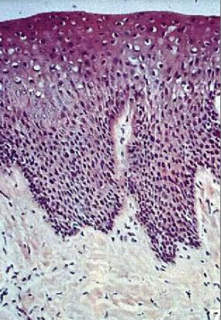 <p>what type of epithelium is this </p>