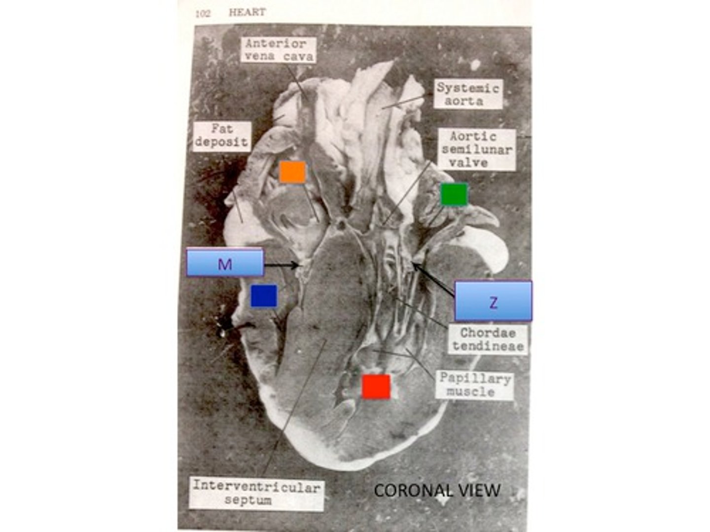 <p>What is Z pointing to? The structure connected to the stringy bits</p>