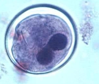 <p>Identify the organism and stage</p>