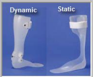 <p>What are the advantages and disadvantages of a dynamic type AFO?</p>