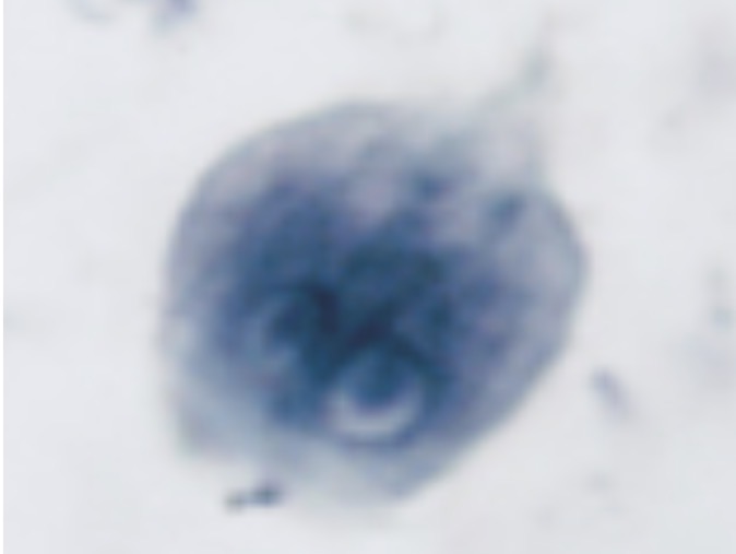 <p>Identify the diplomonad. Most common intentional parasitic disease affecting humans </p>