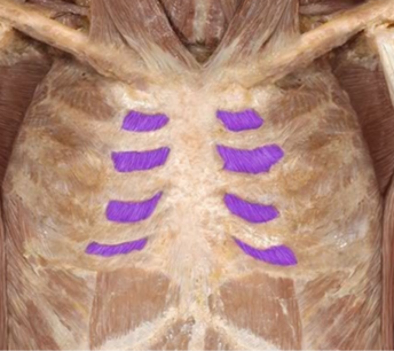 <p>What is the name of this muscle, highlighted in purple?</p>