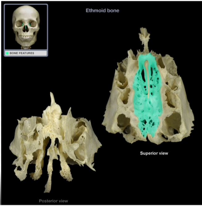 <p>Cribiform Plate</p>