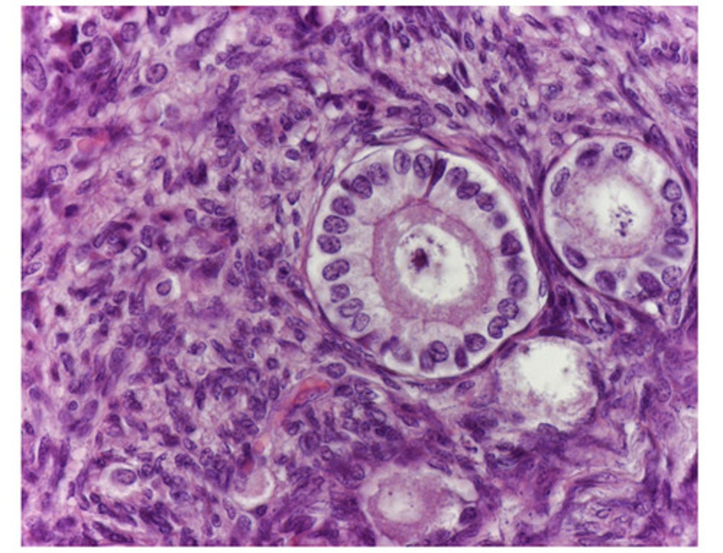 <p>what type of follicle?</p>