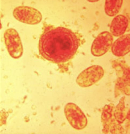 <p><em>Ancylostoma caninum</em> - canine hookworm (egg)</p>