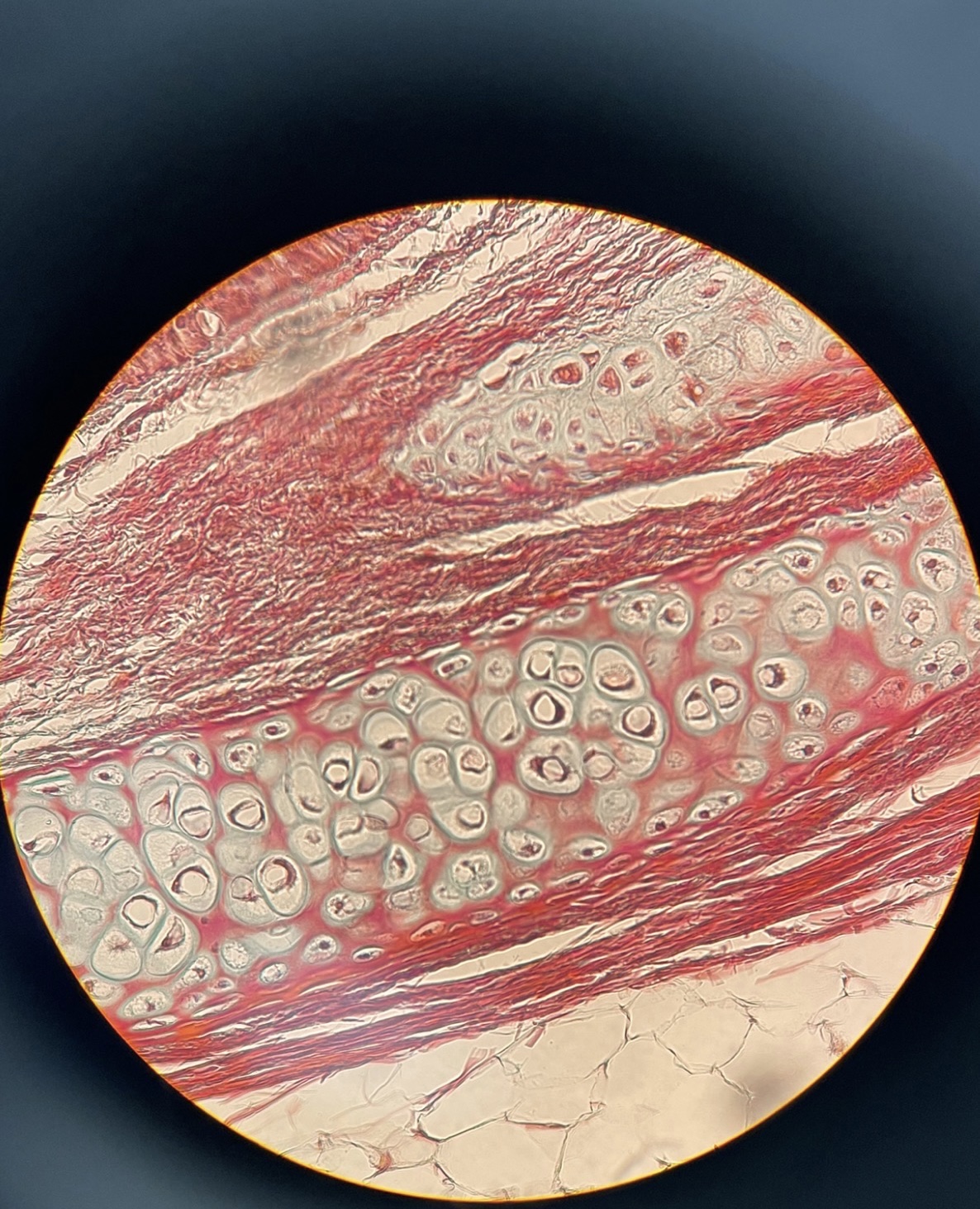 <p>Location: Trachea Function: Produces and moves mucous (Epithelial tissue)</p>