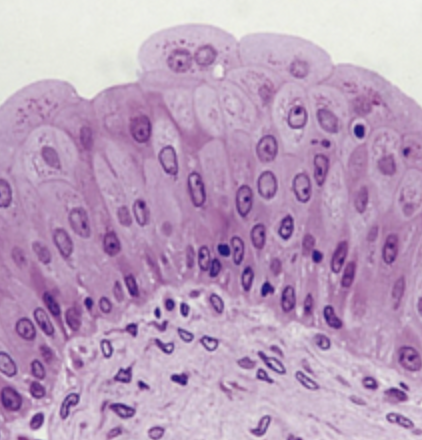 <ol start="6">
<li>What is the urinary bladder lined with?</li>
</ol>