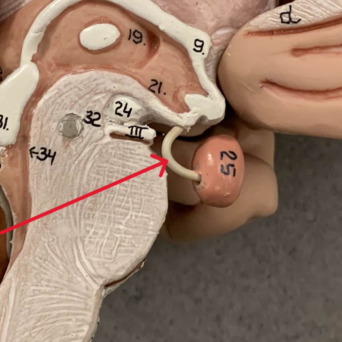 <p>Which part of the brain is:</p><ul><li><p>Funnel-shaped</p></li><li><p>Connects hypothalamus to pituitary gland</p></li></ul><p></p>