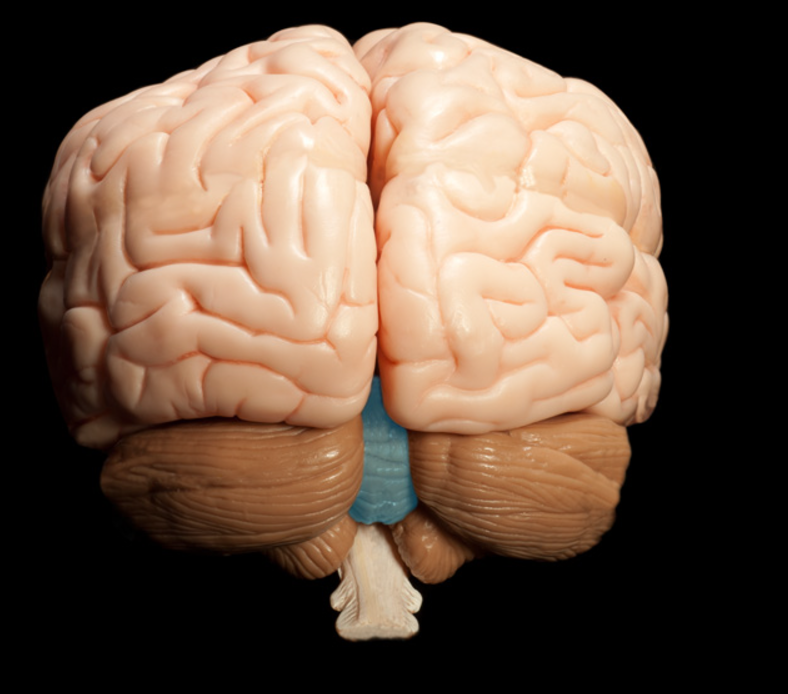 <p>what is this part of the cerebellum</p>