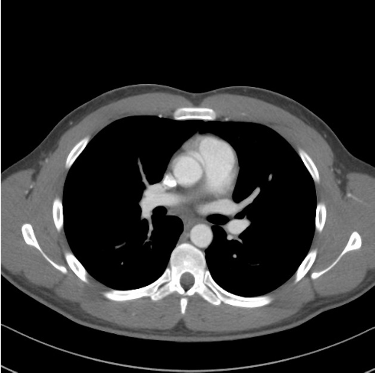 <p>test to see blood vessels (especially pulmonary) with radio-opaque contrast</p>