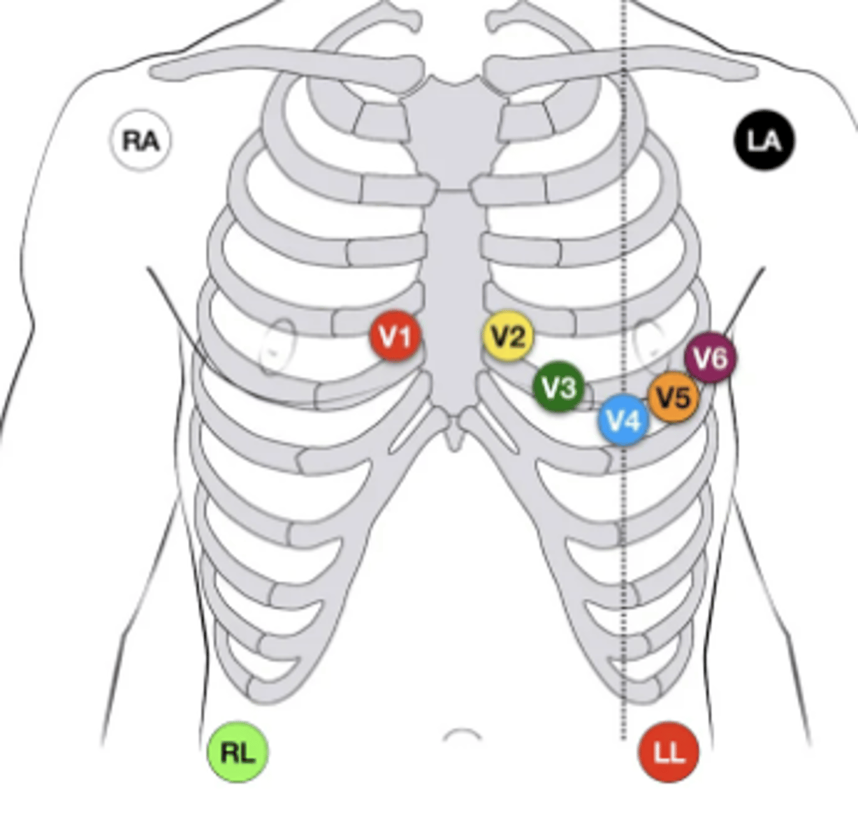 <p>Limb: I, II, III, aVR, aVL, aVF</p><p>Precordial: V1-V6</p>