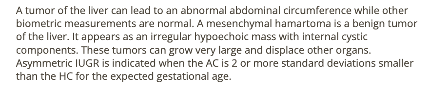 <p>b) hepatic mesenchymal hamartoma</p>
