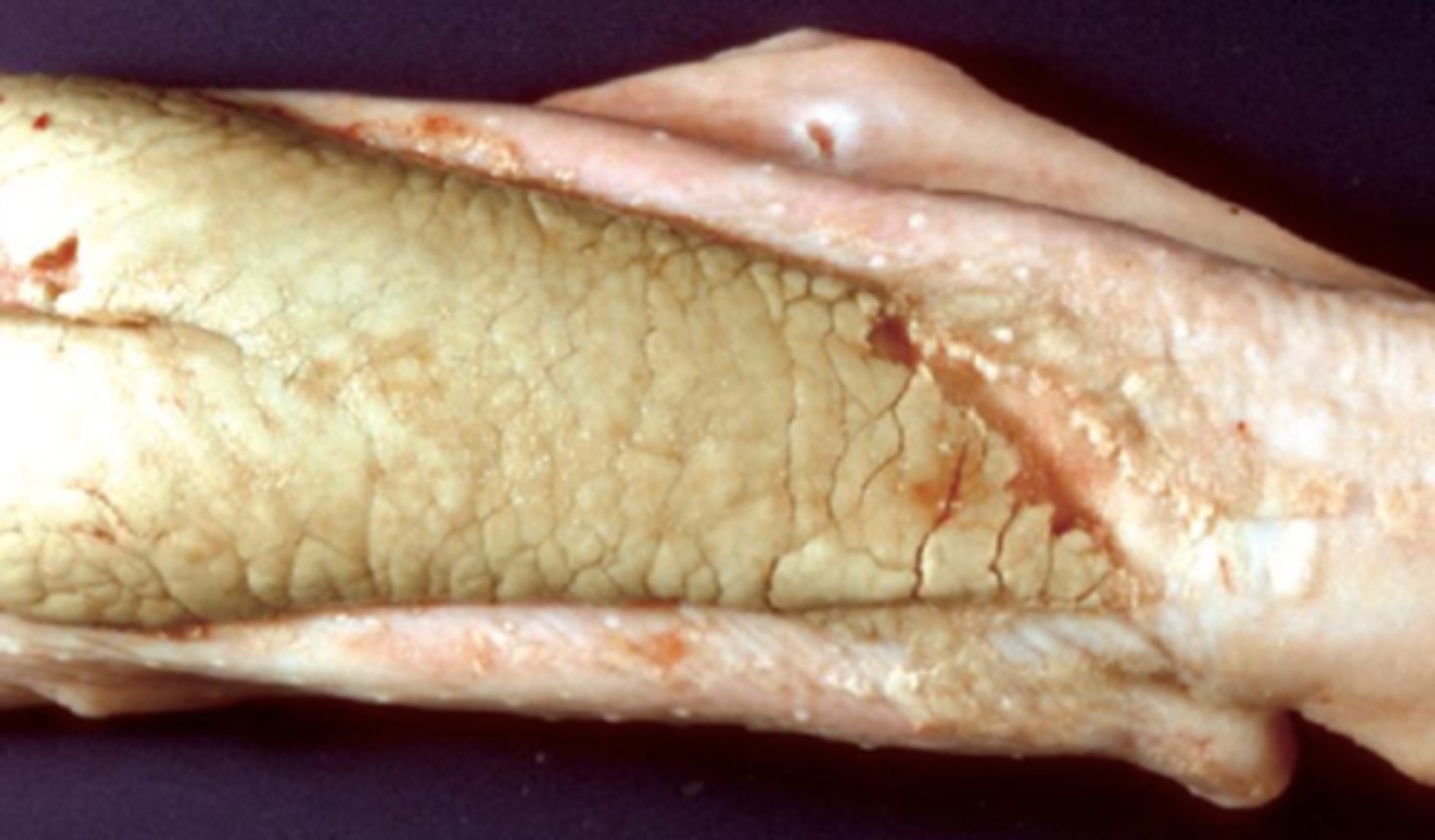 <p>diagnosis morfológica:</p>