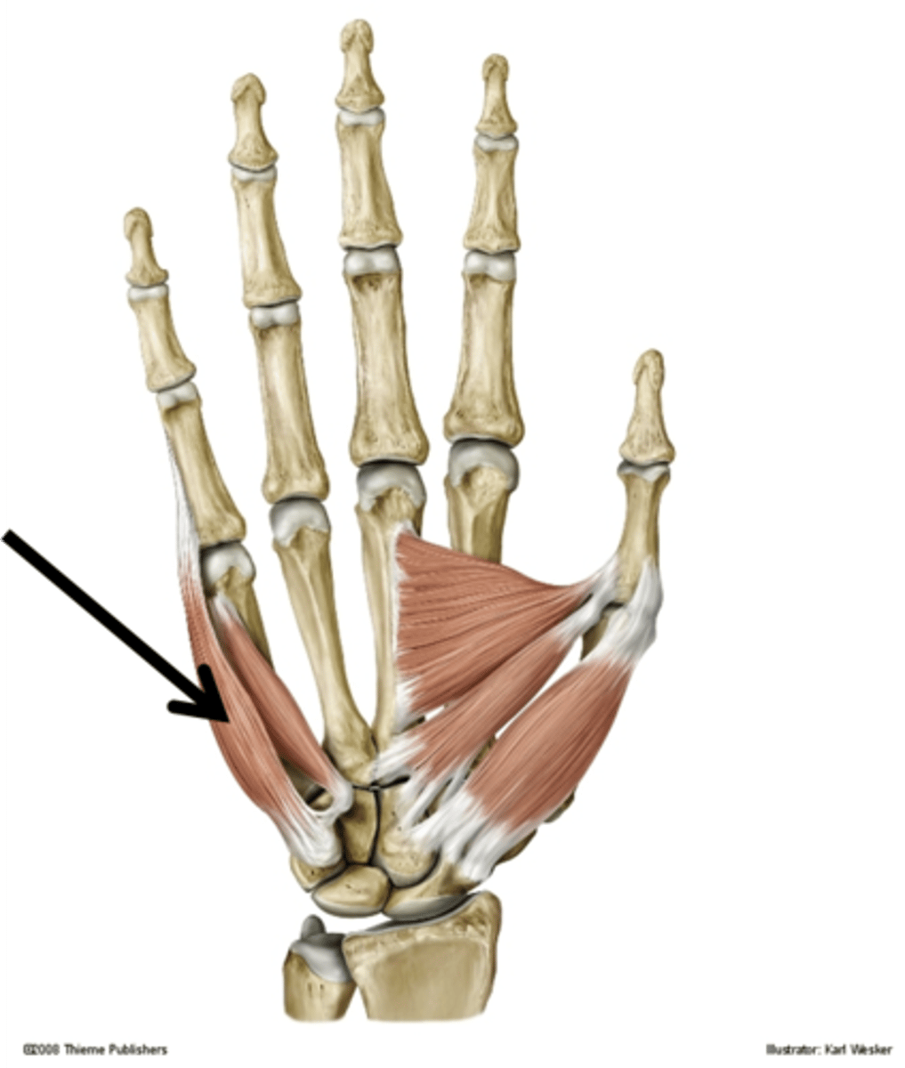 <p>carpal bones</p>