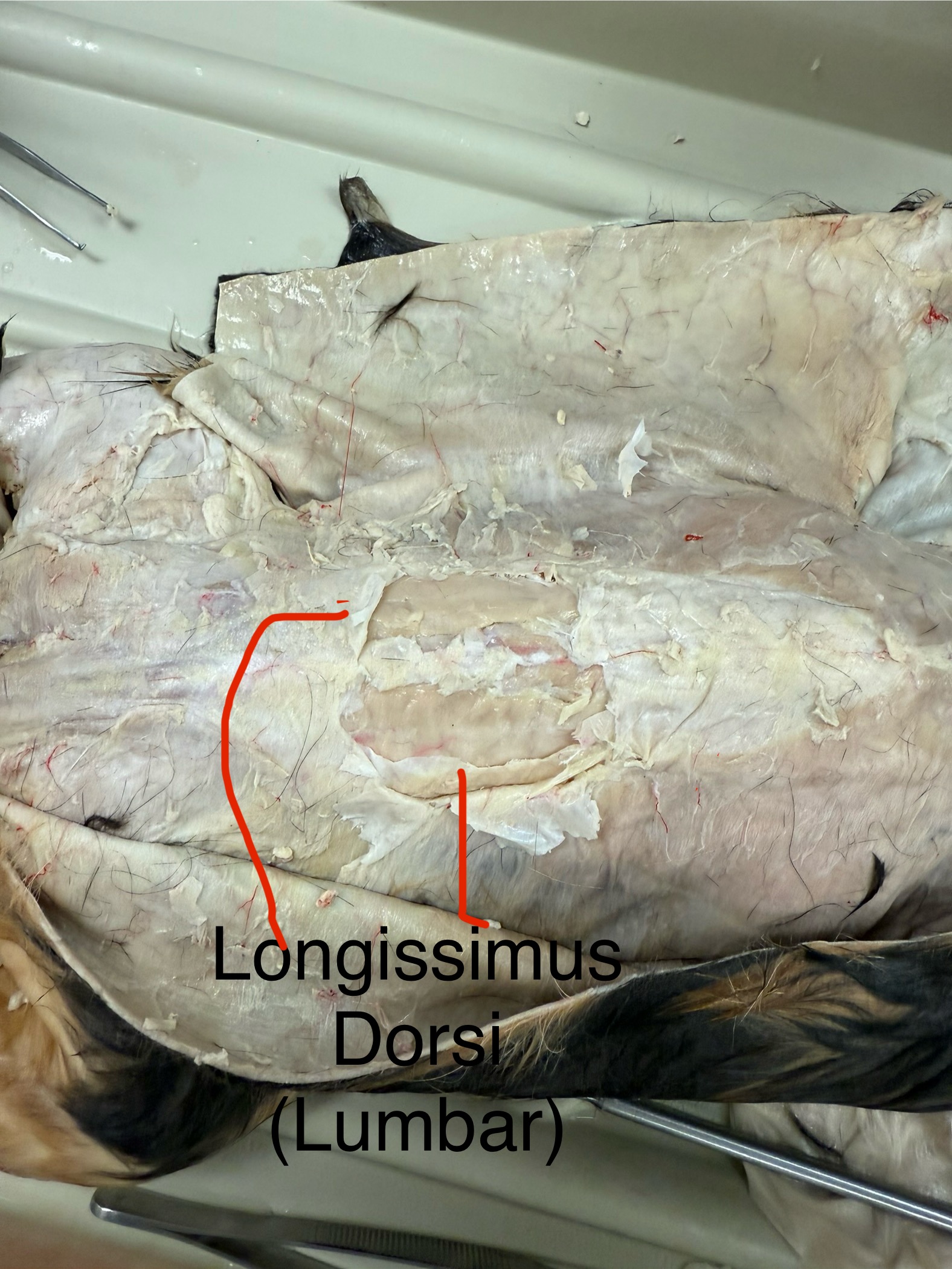 <p>Action: extends vertebral column</p>