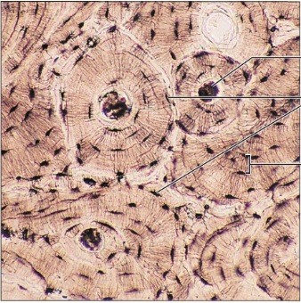 type of connective tissue?