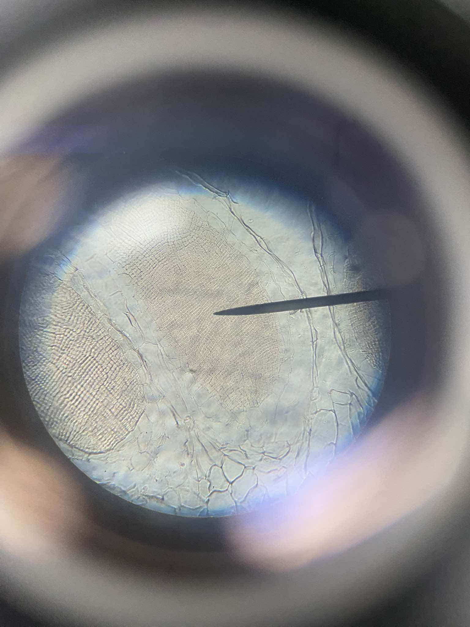 <p>male sex organ of Marchantia sp.; found in the disc and is structurally elongated and covered by a single layered sterile jacket; inside are large numbers of androcytes that produce uninucleate biflagellate antherozoid</p>