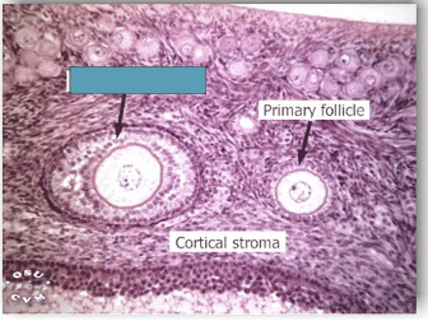 <p>Identify the stage of the follicle</p>