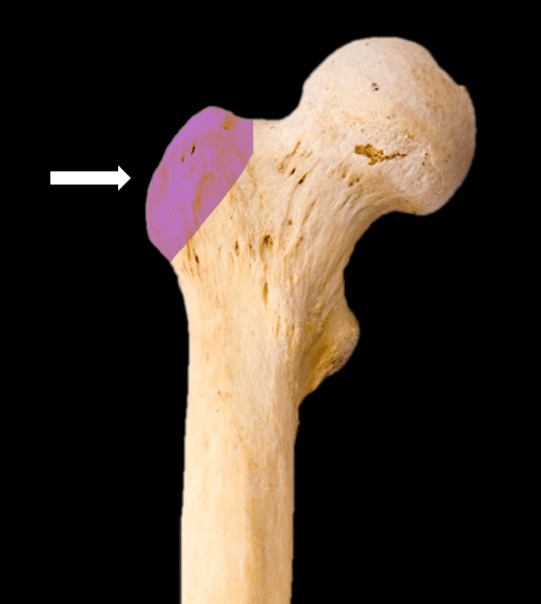 <p>name the part</p>